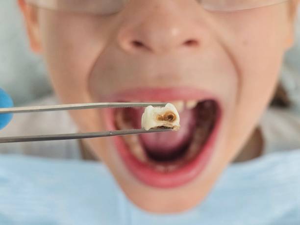 Best Emergency Pediatric Dental Care in Star City, WV